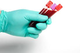 Medicare Phlebotomy Training Courses in London